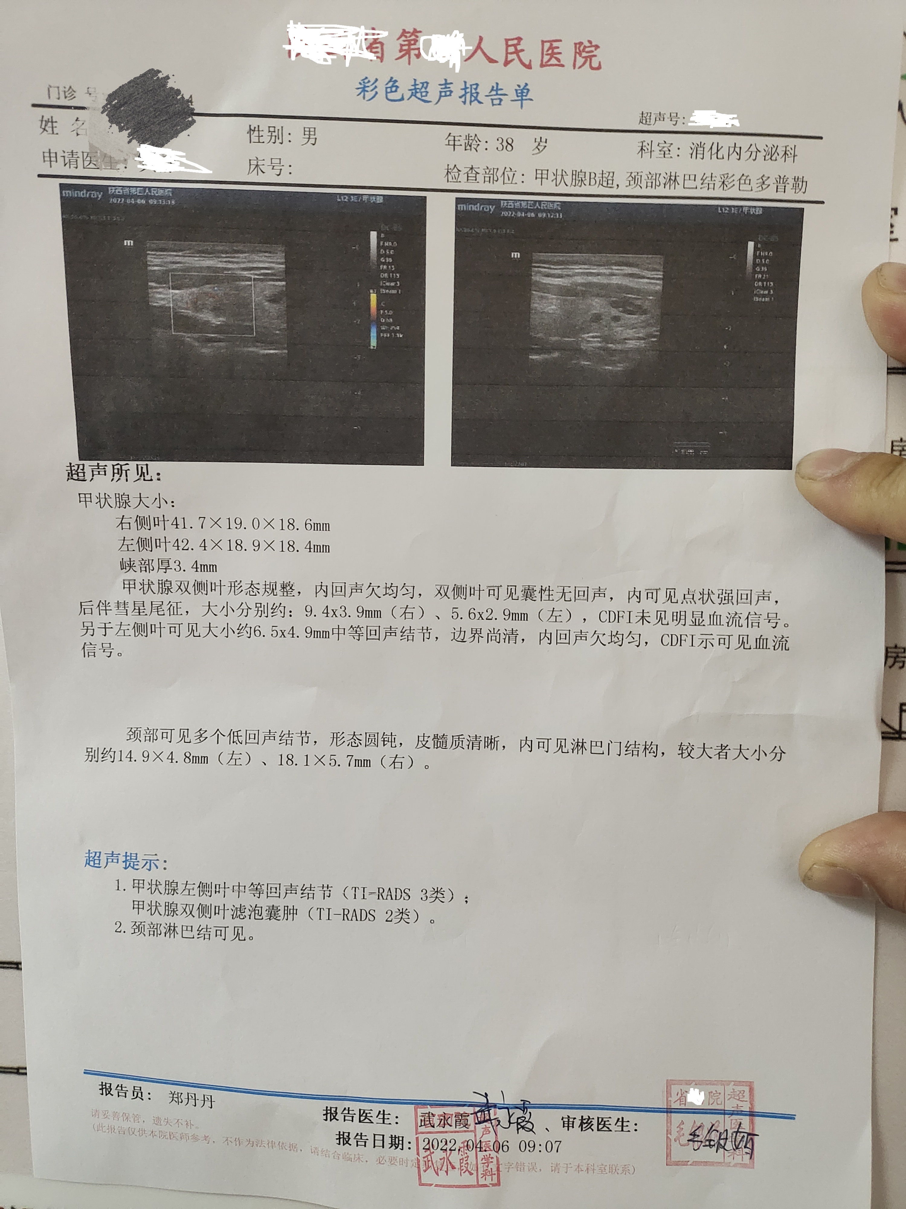 [经验]  甲状腺结节吃中药后的效果~